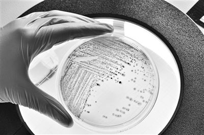图为在培养皿中生长的大肠杆菌。 视觉中国供图